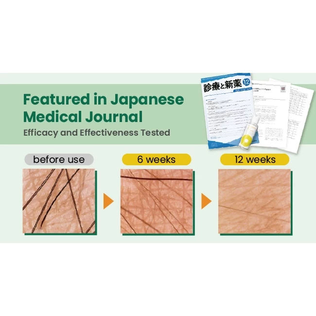 Lotion anti-pilosité premium à l'ananas et au lait de soja 100 ml (Haute concentration, réduit la pousse des poils) (Usage quotidien) (Visage, corps, maillot) (À base d'ingrédients naturels)