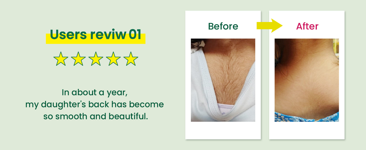 Pineapple and Soy Milk Hair Inhibitor Lotion Premium 100mL (High Conce